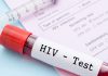 test anti-HIV consenso informato