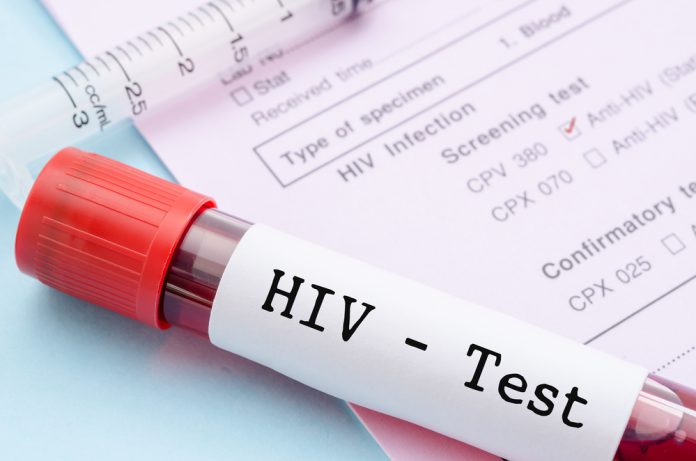 test anti-HIV consenso informato